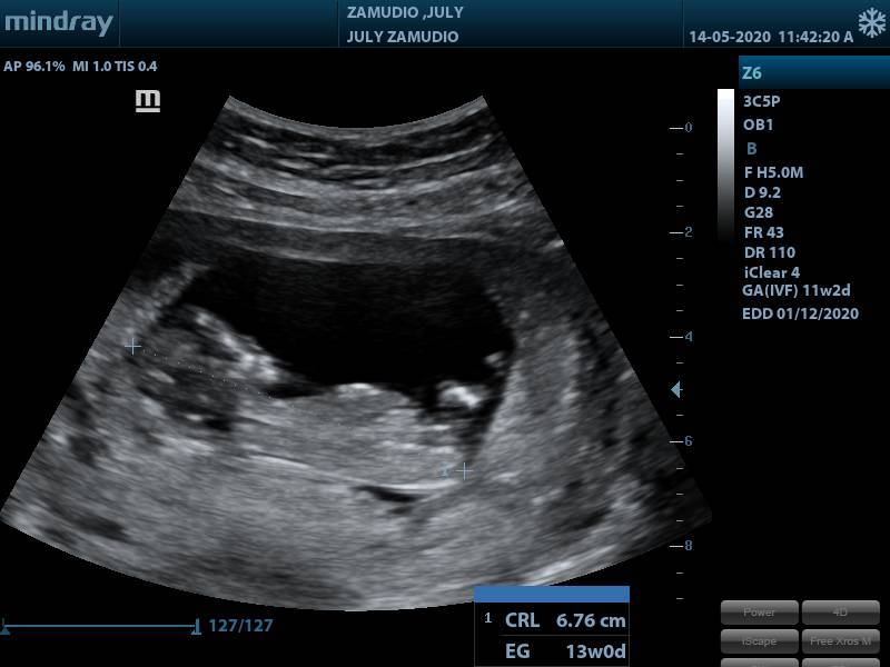 J'ai fait un vœu et tu es devenu réalité