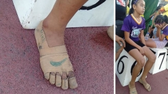 붕대로 만든 '나이키' 신발 신고 금메달 딴 필리핀 11살 육상선수