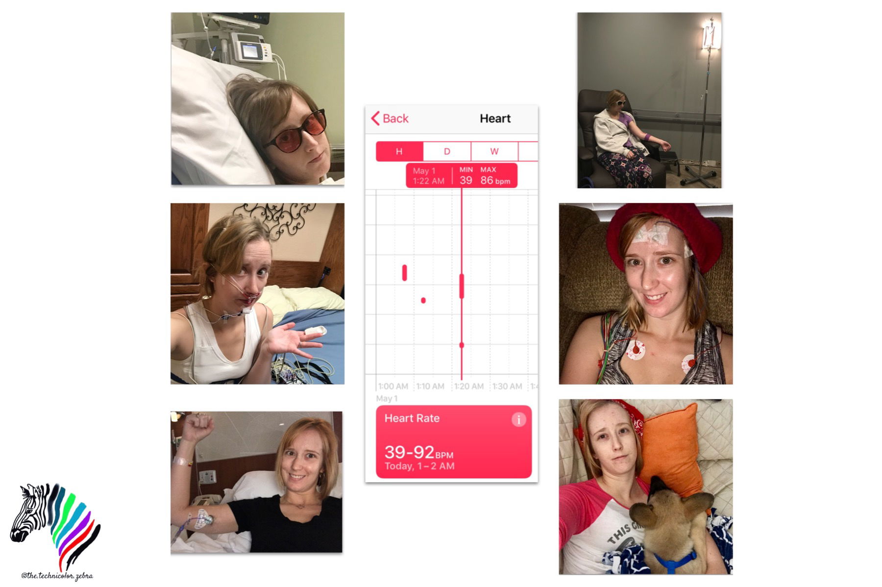 Autopilot Failure My Journey to My Gastroparesis Diagnosis