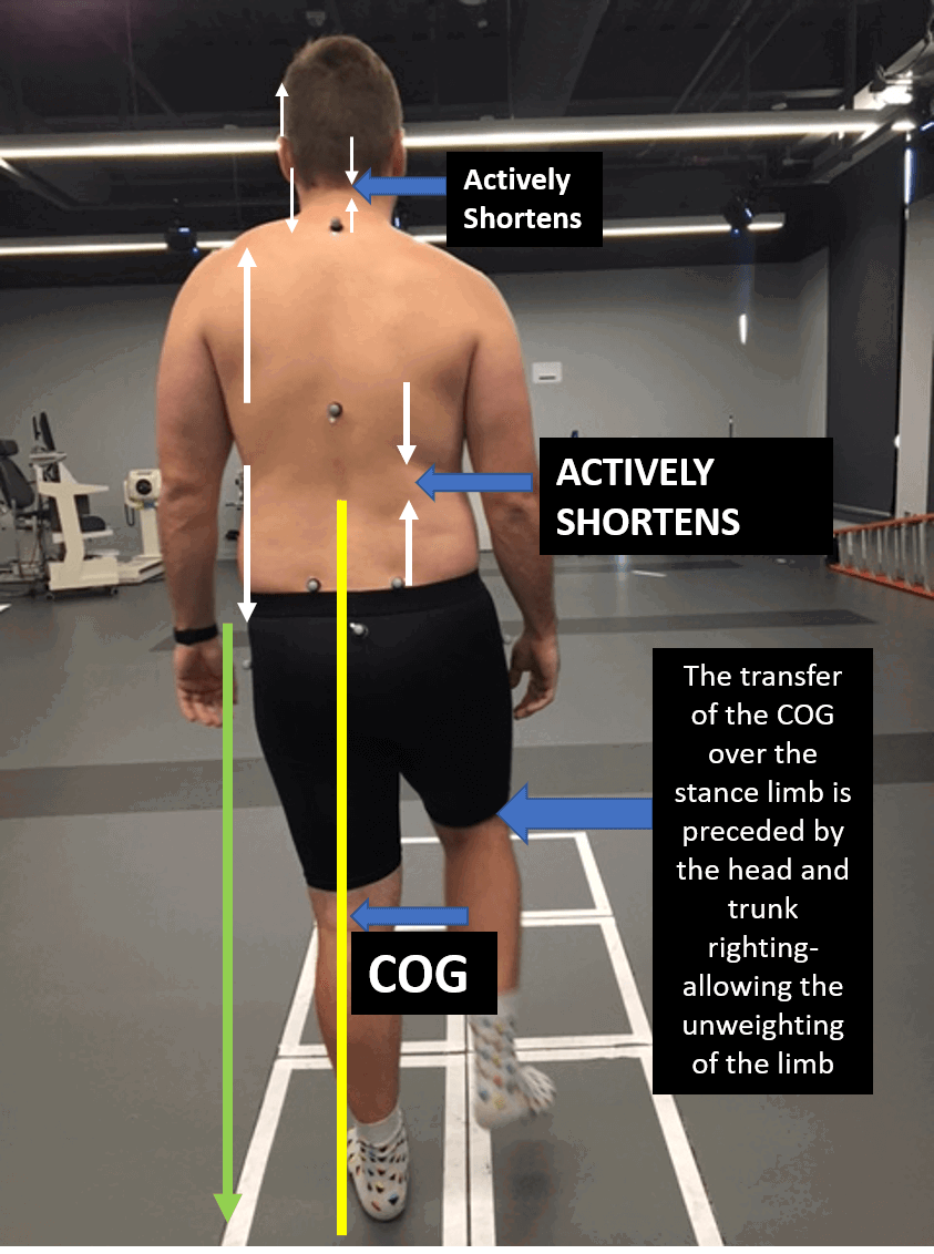Transitioning to SLS - Movement Solutions for PT