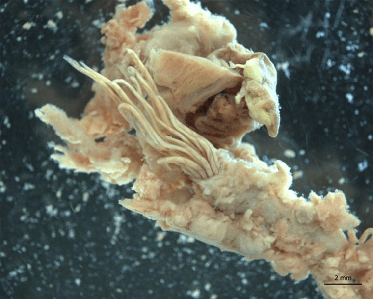 The noodle-like organisms in the center of this photo are adult rat lungworms emerging from the pulmonary artery of a rat.