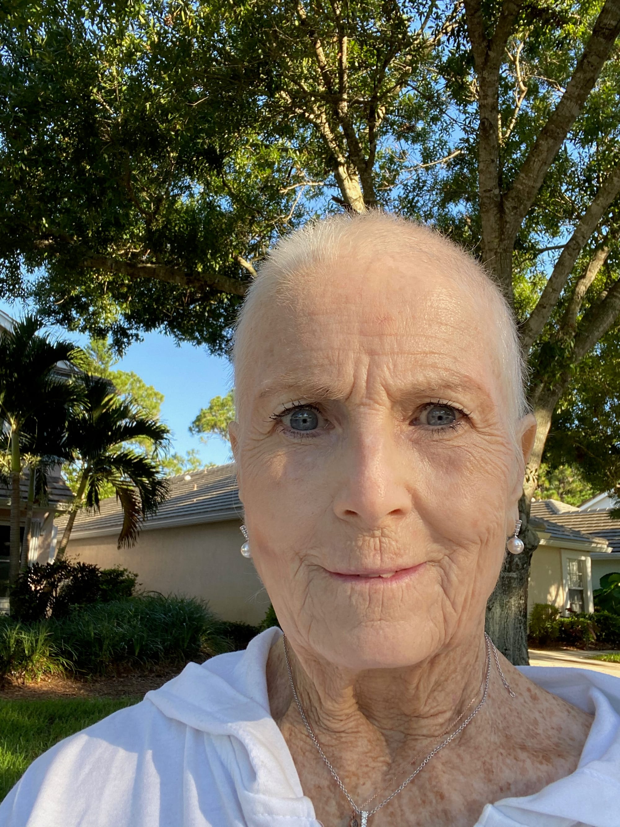 8 Living with the Many Side Effects journeyswithkatwright