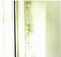 Figure 7 The condensation and mildew on the installation part on the side of the window frame