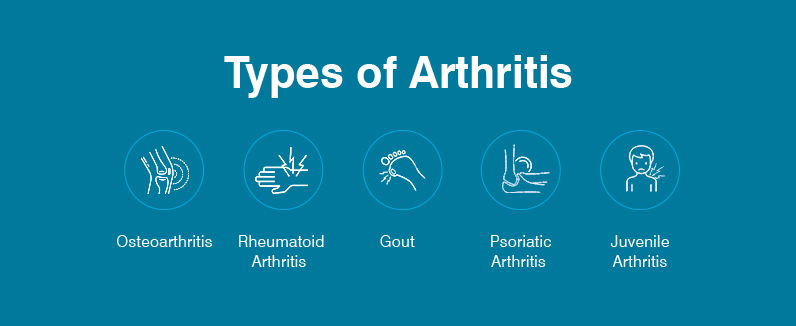 Forever Joint Pains Pack a Natural Treatment for Arthritis Problem