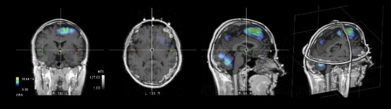 Gabriel-Technologie FR - Tests EEG - Effets sur le cerveau im02