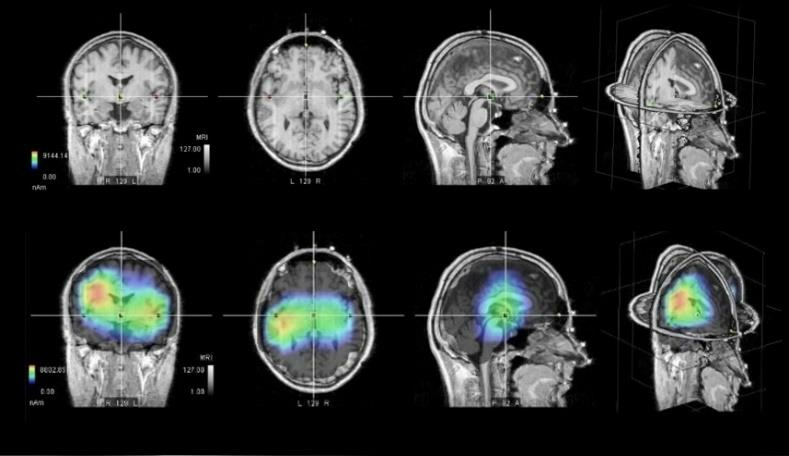 Gabriel-Technologie FR - Tests EEG - Effets sur le cerveau im03