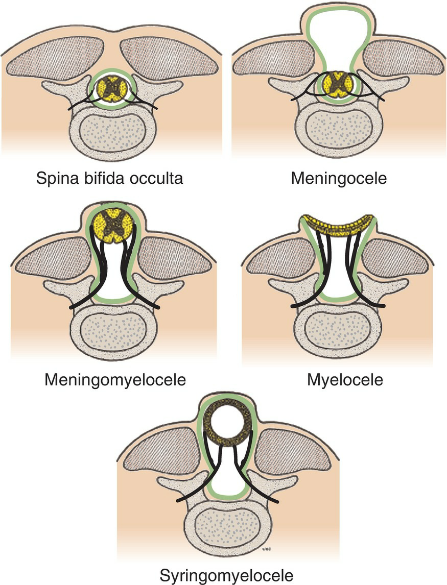 Vertebral Column Development 7