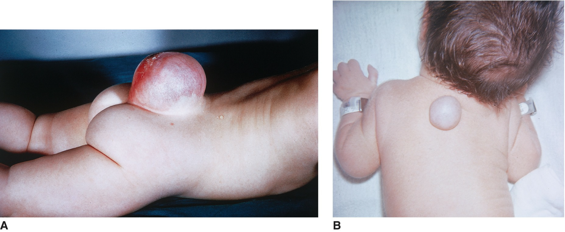 Vertebral Column Development 8