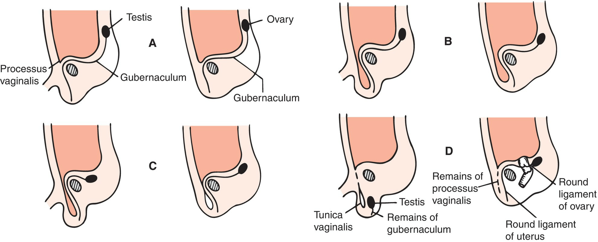 Inguinal Canal Development 3