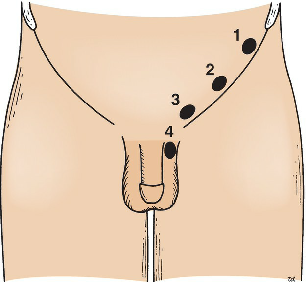 Testis Development 2
