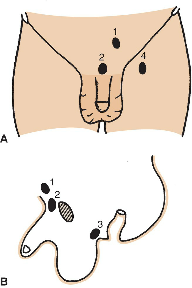 Testis Development 3