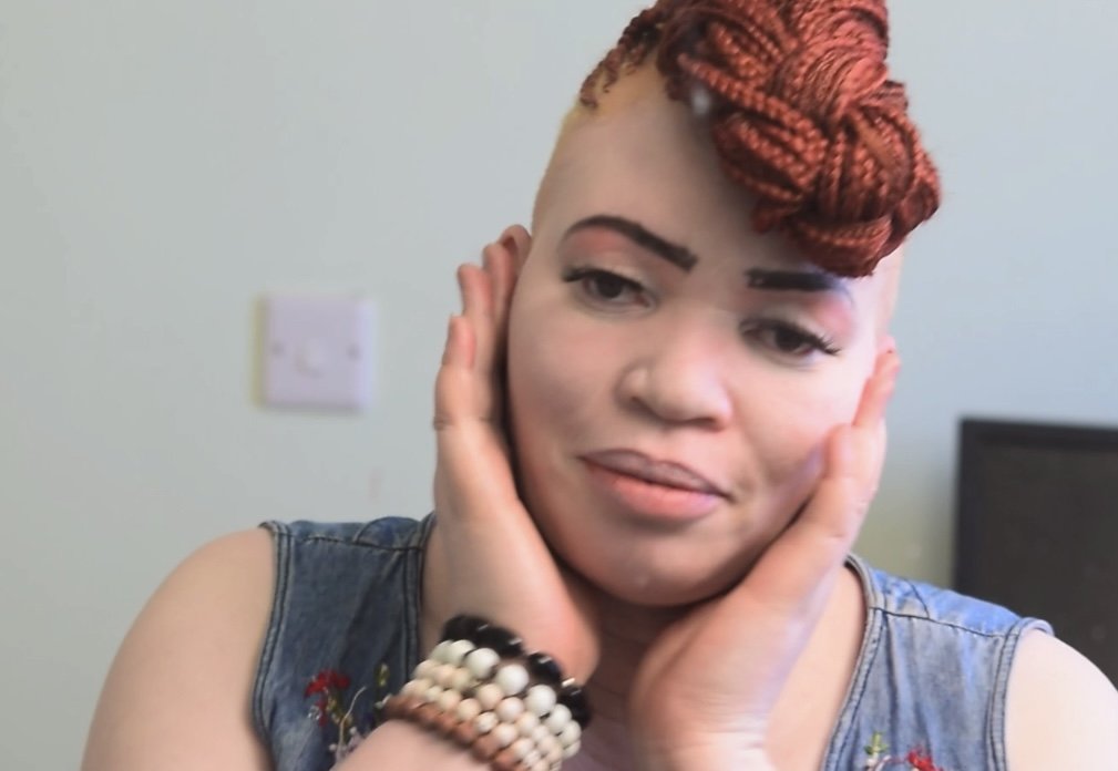 Albinism & Makeup: The Challenges of Choosing a Foundation