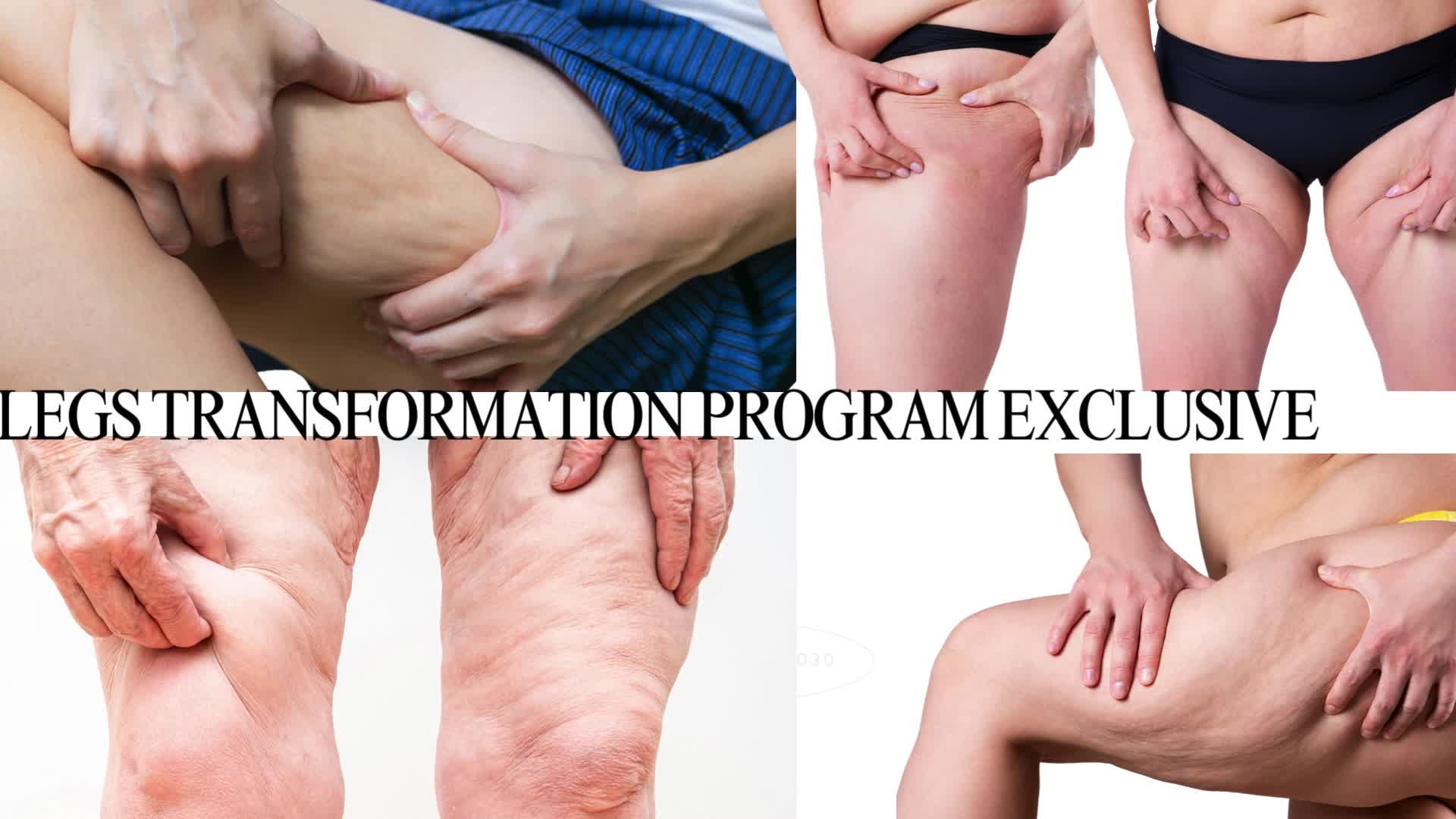 Legs Transformation Exclusive develop by wellness&lifestyle clinic thumbnail