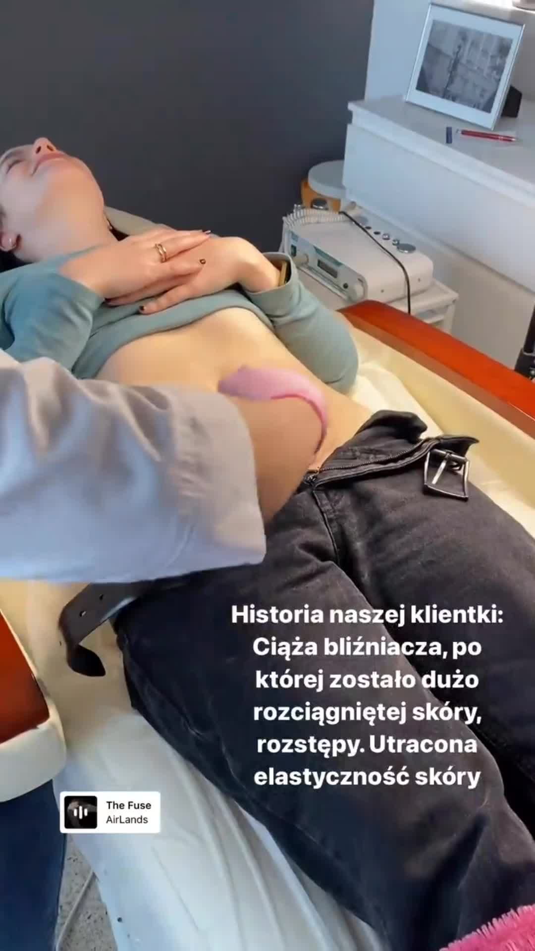Mezoterapia   thumbnail