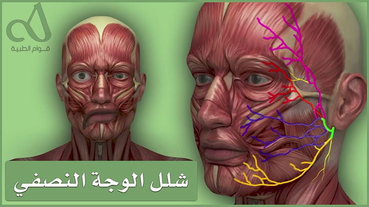 паралич Белла
