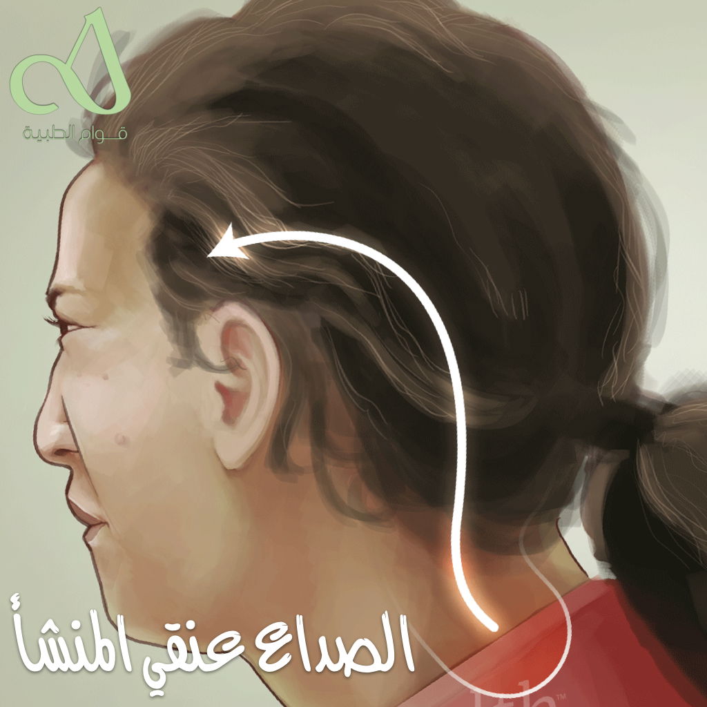 Головная боль шейного происхождения